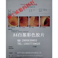 南京市A4瓷白医用胶片 南京市A4瓷白医用胶片